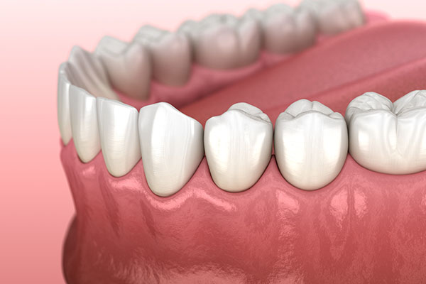 Bleeding Gums And Gumline Infection